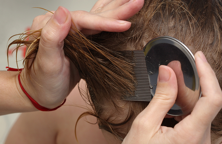 Getting rid of lice