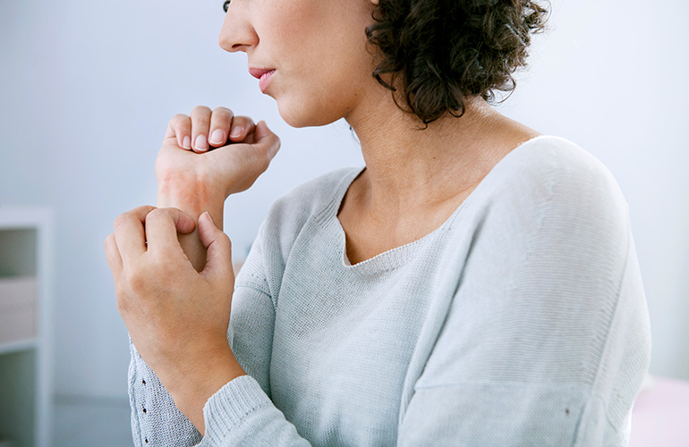 Treating eczema