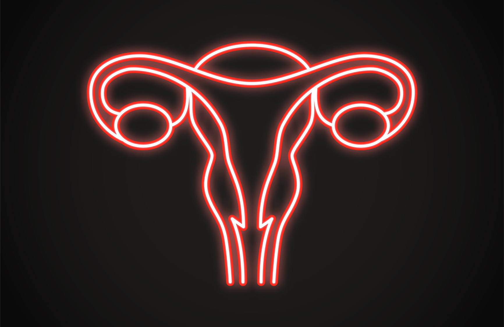 Ovarian cancer