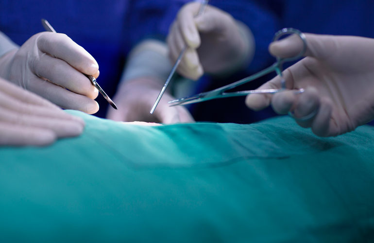 Surgery