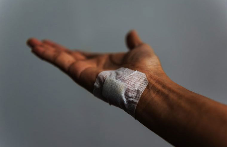 Slow wound healing