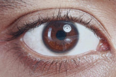 10 types of vision loss and what they mean