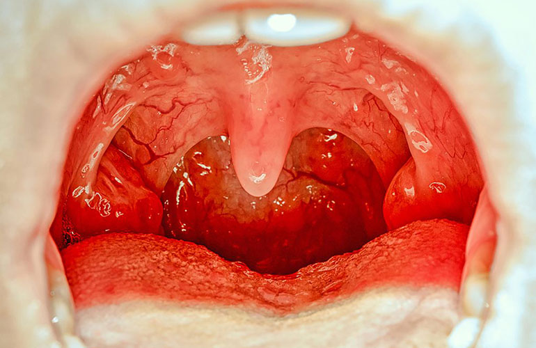 Uvula