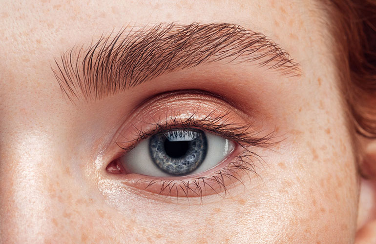 Critters in your eyelashes and eyebrows