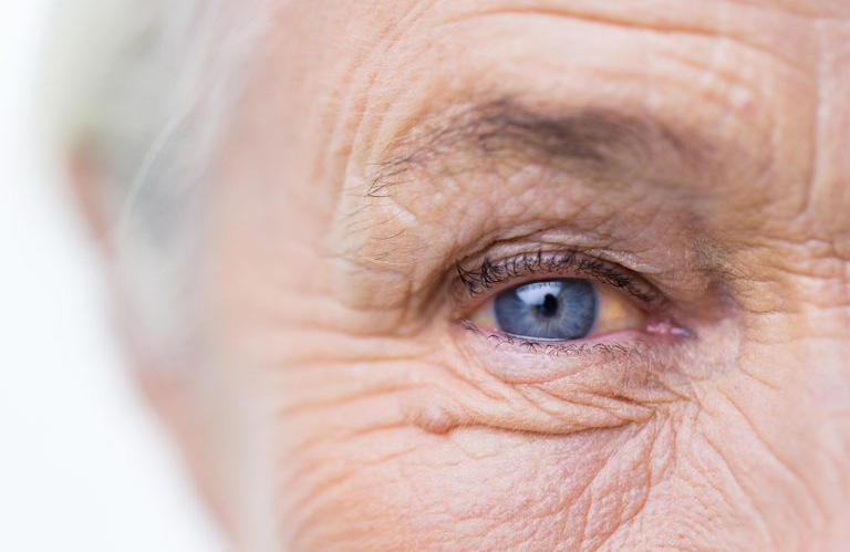 What causes vision loss?