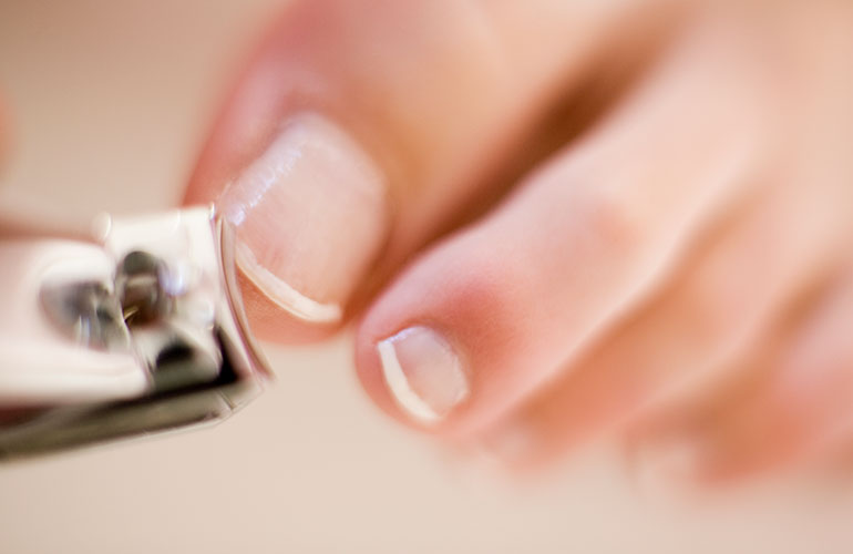 Your toenails are cut funny