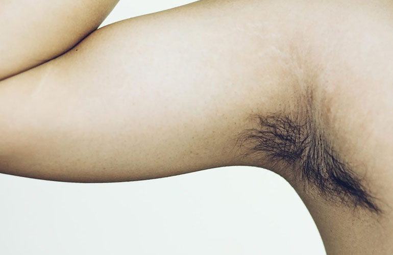 Smelly microbes in your armpits