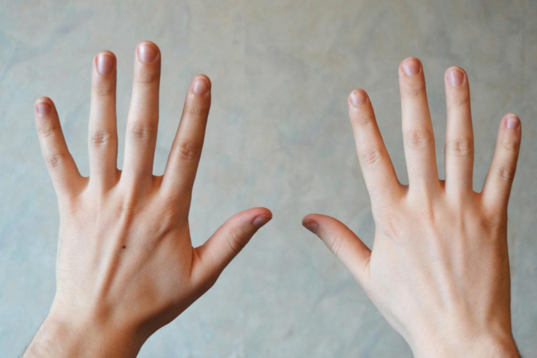 The multitudes on your hands