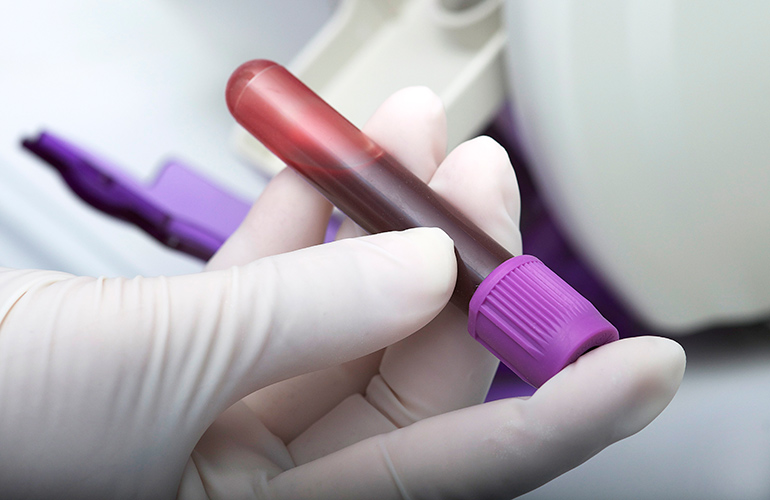 Get screened