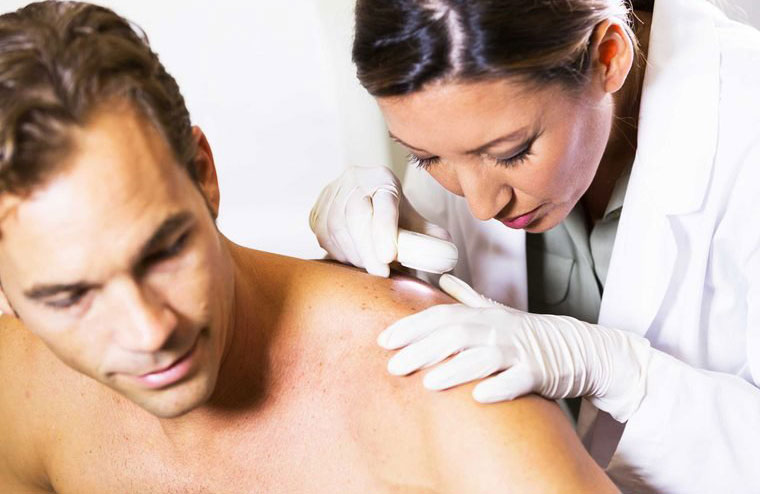 Shingles symptom: painful blisters