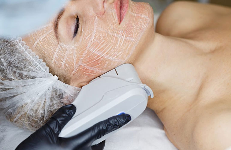 Ultherapy