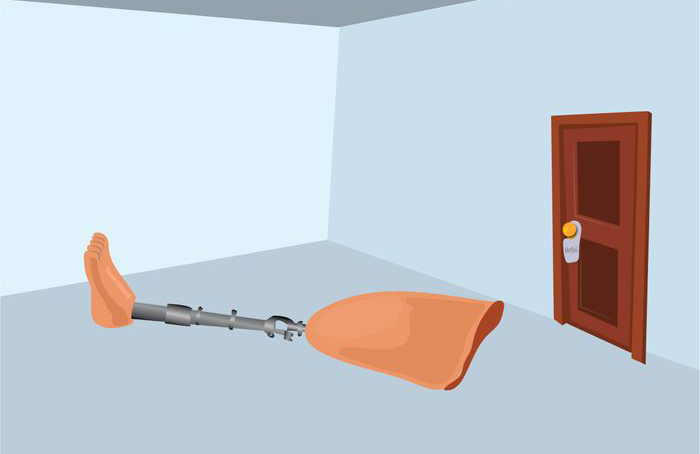 A prosthetic limb