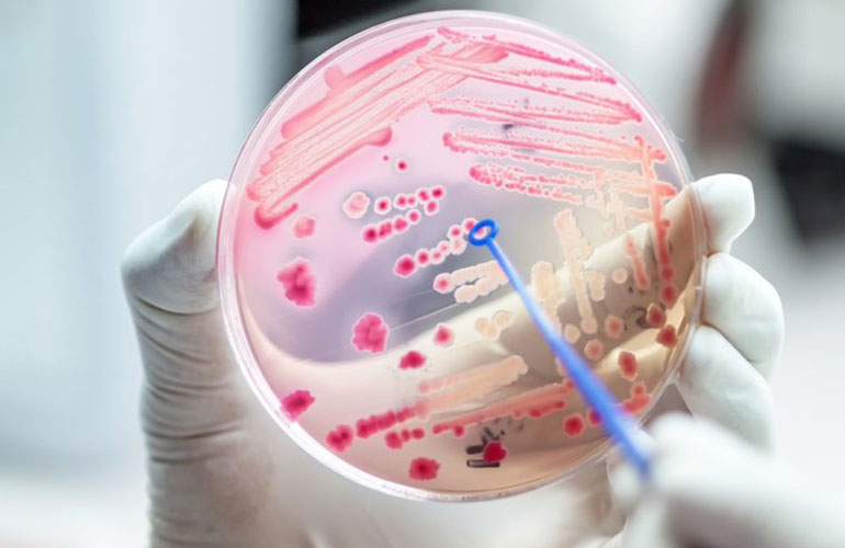 Bacterial infections