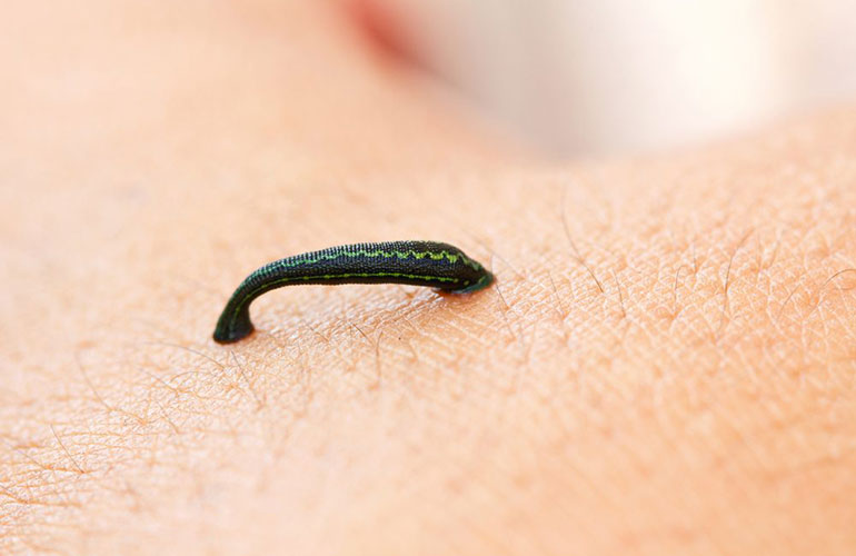 We have a secret weapon we can use when things go wrong: leeches
