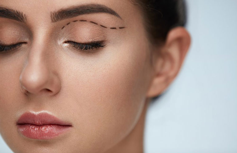 If your drooping eyelids are partially blocking your vision, your insurance may pay for a lid lift