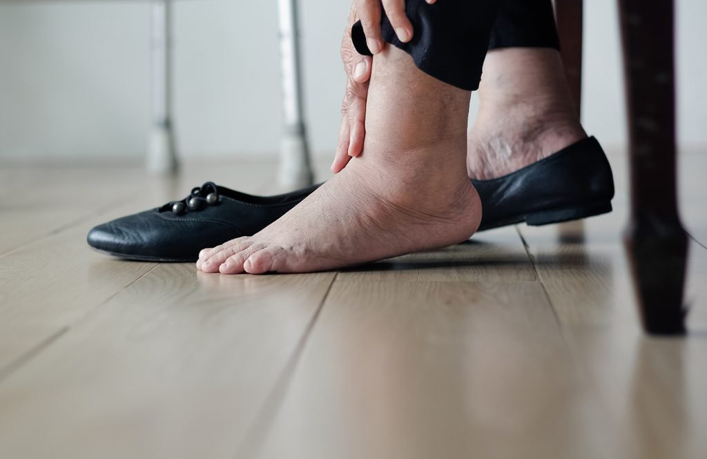 Your lower legs and feet swell up unexpectedly