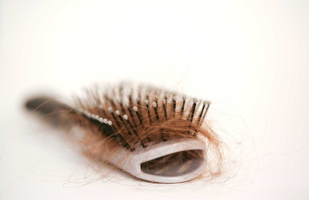 You’re losing hair where you want it