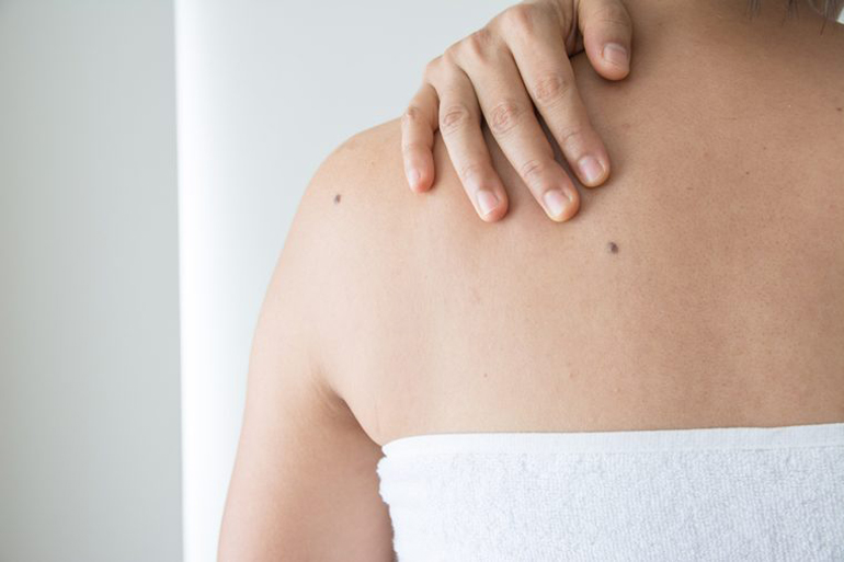 Bad posture can trigger muscle spasms