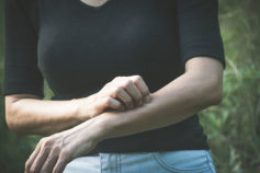 11 things your itchy skin can reveal about your health