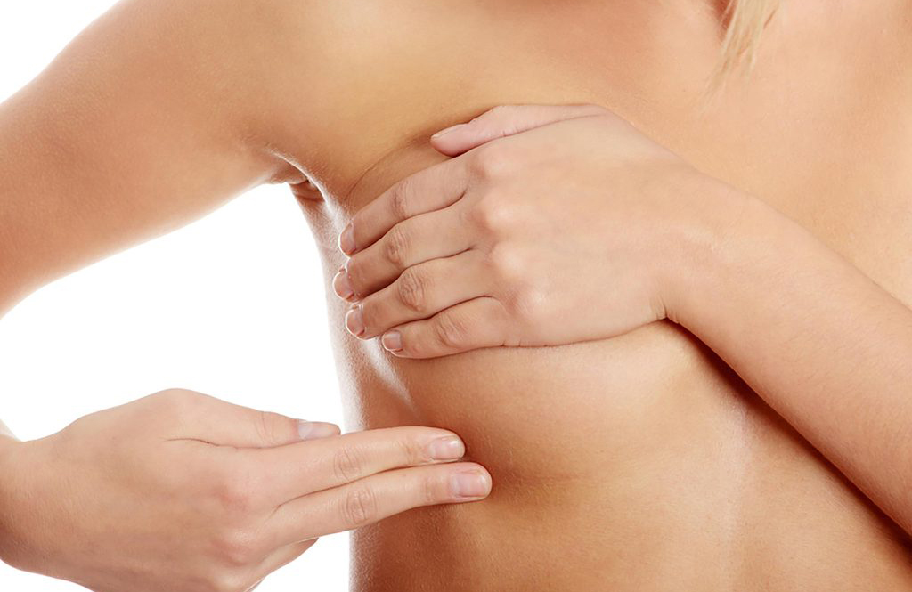 Is it a breast cyst?