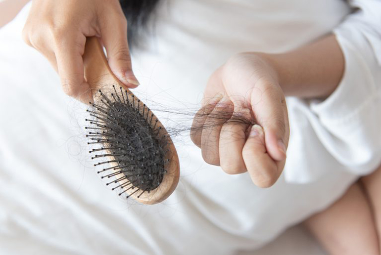 Your hair is thinning