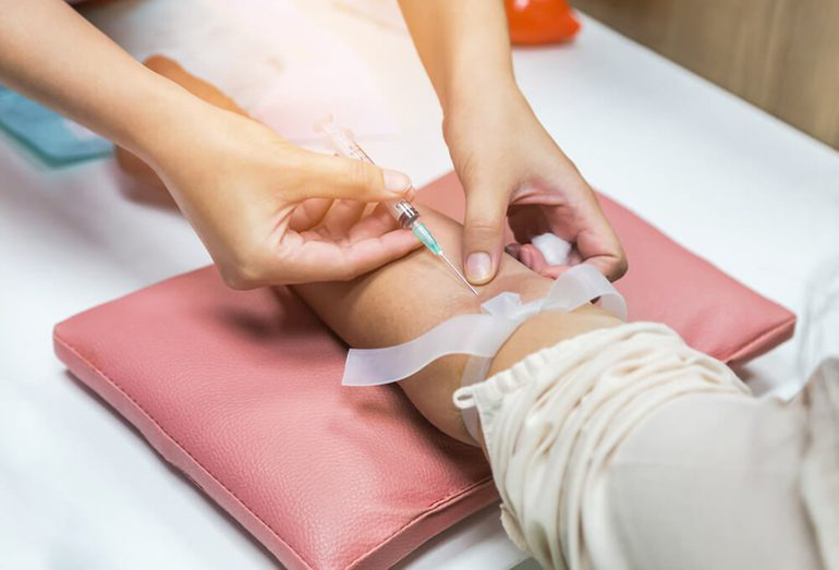 Diagnosing Hashimoto’s disease by symptoms alone is tricky