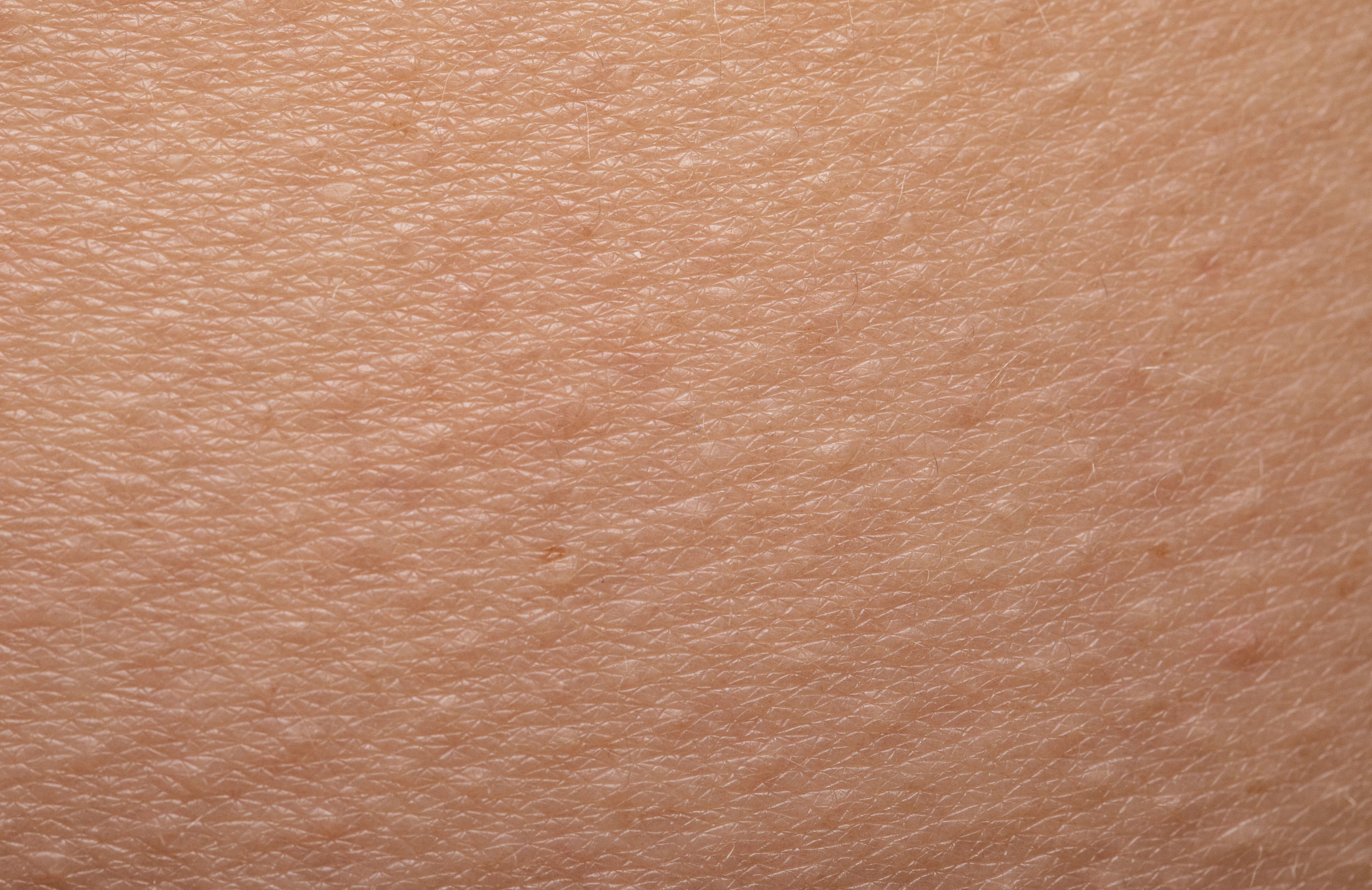 Bumps on the backs of arms