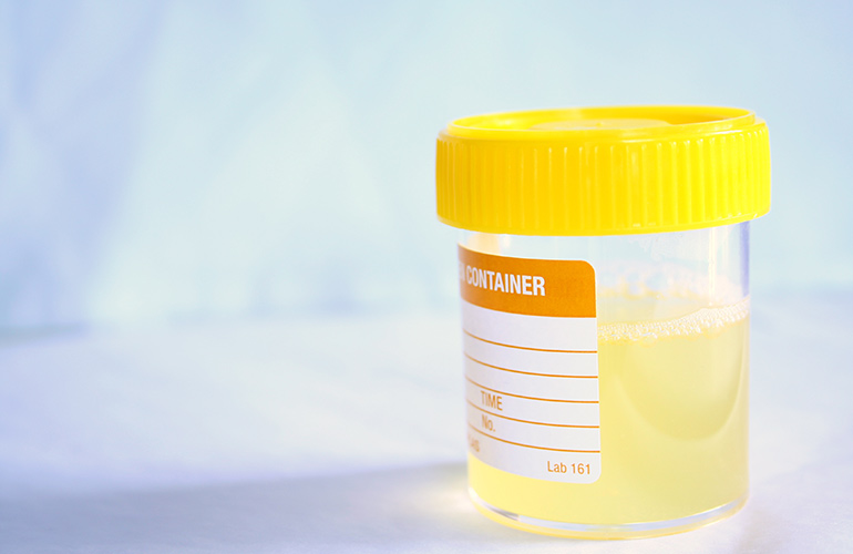 Please don’t take it personally when I ask you to take a drug test