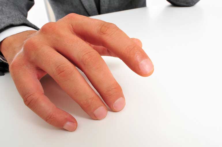 Fingerprints reveal: High blood pressure