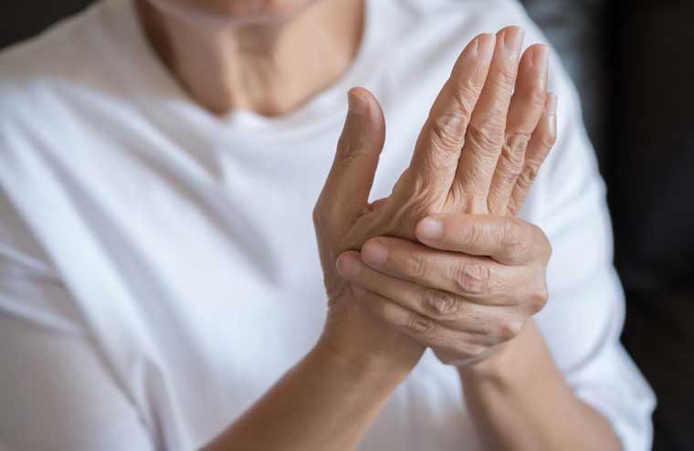Blotchy, red palms reveal: Liver disease