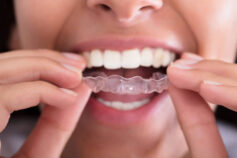 9 habits that secretly annoy your dentist
