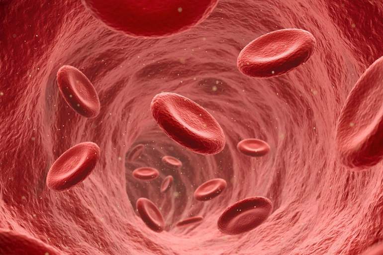 Anaemia