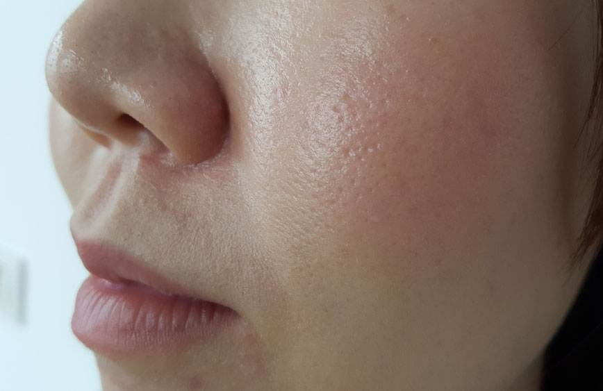 Your pores will look bigger