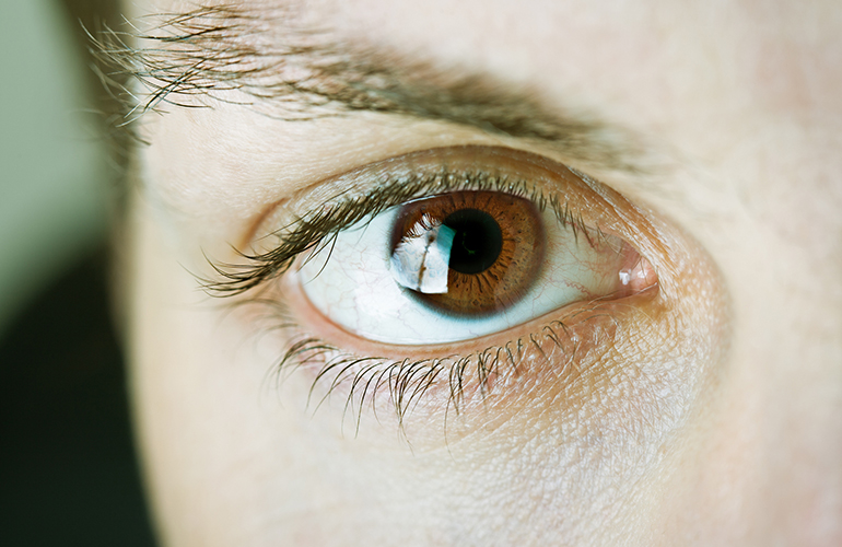 Your under-eye bags get deeper and darker