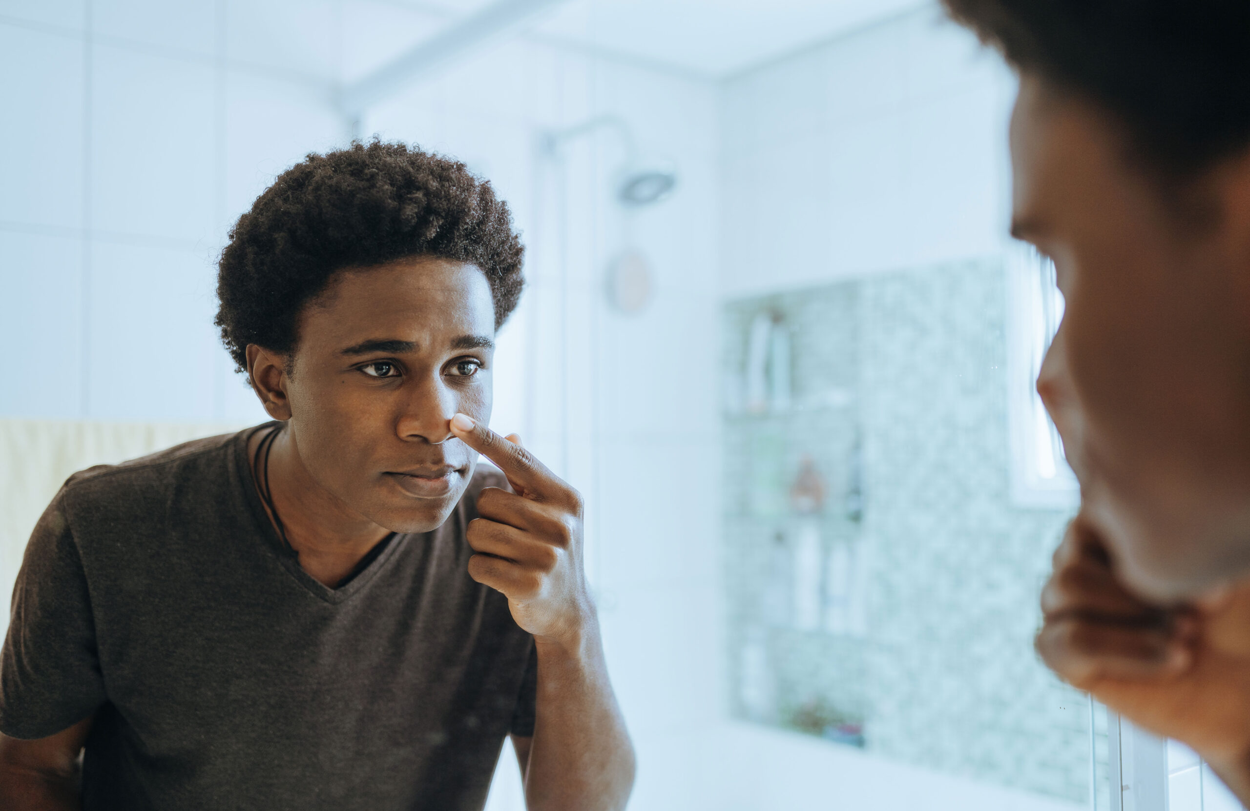 What causes oily skin?