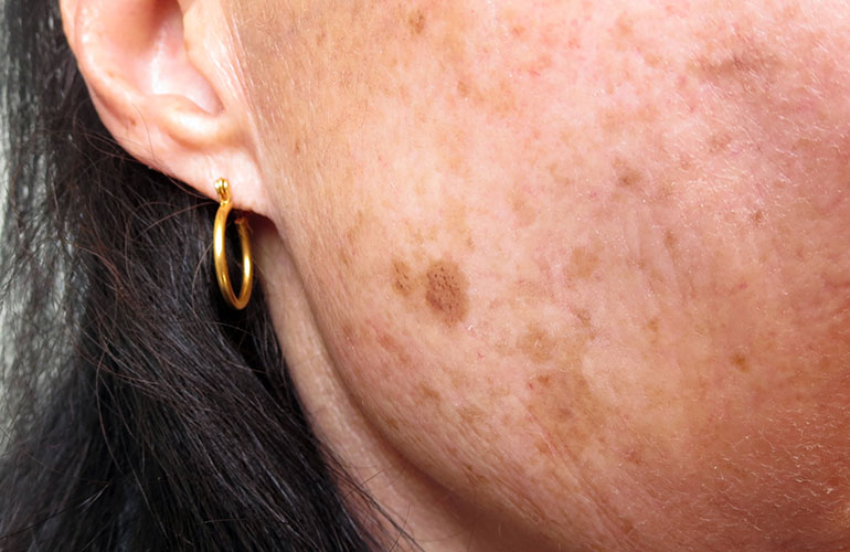 8. Your skin tone