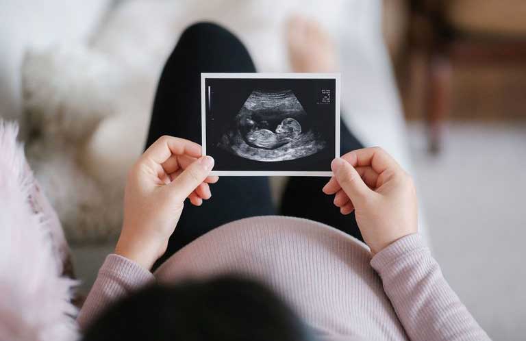 Can you guess some of the most common gender neutral baby names?