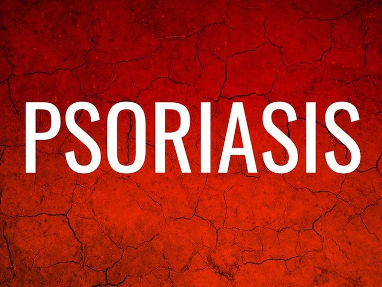Psoriasis