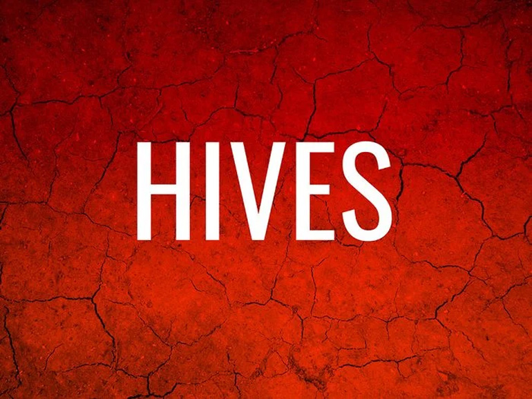 Hives