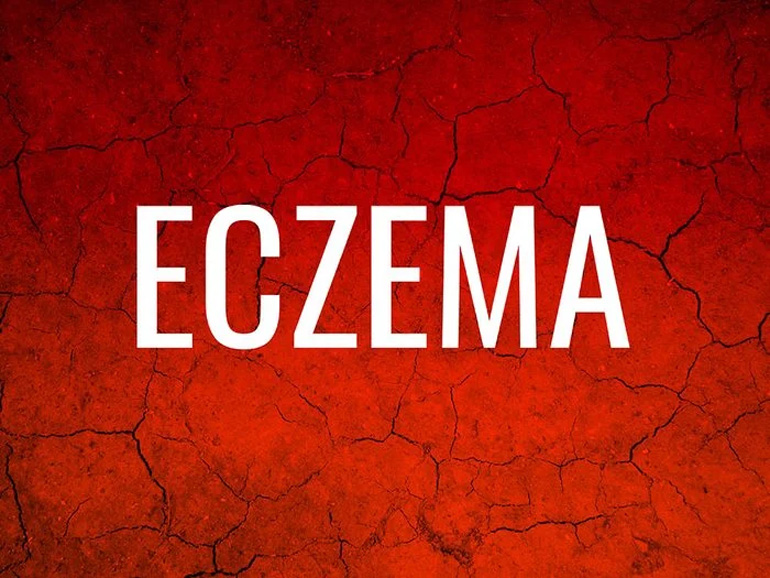 Eczema
