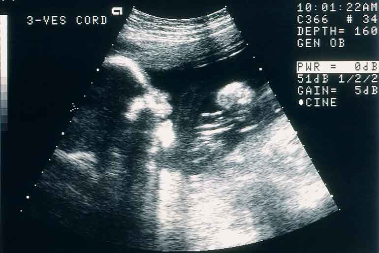 Your fingerprints have been with you since before you were born