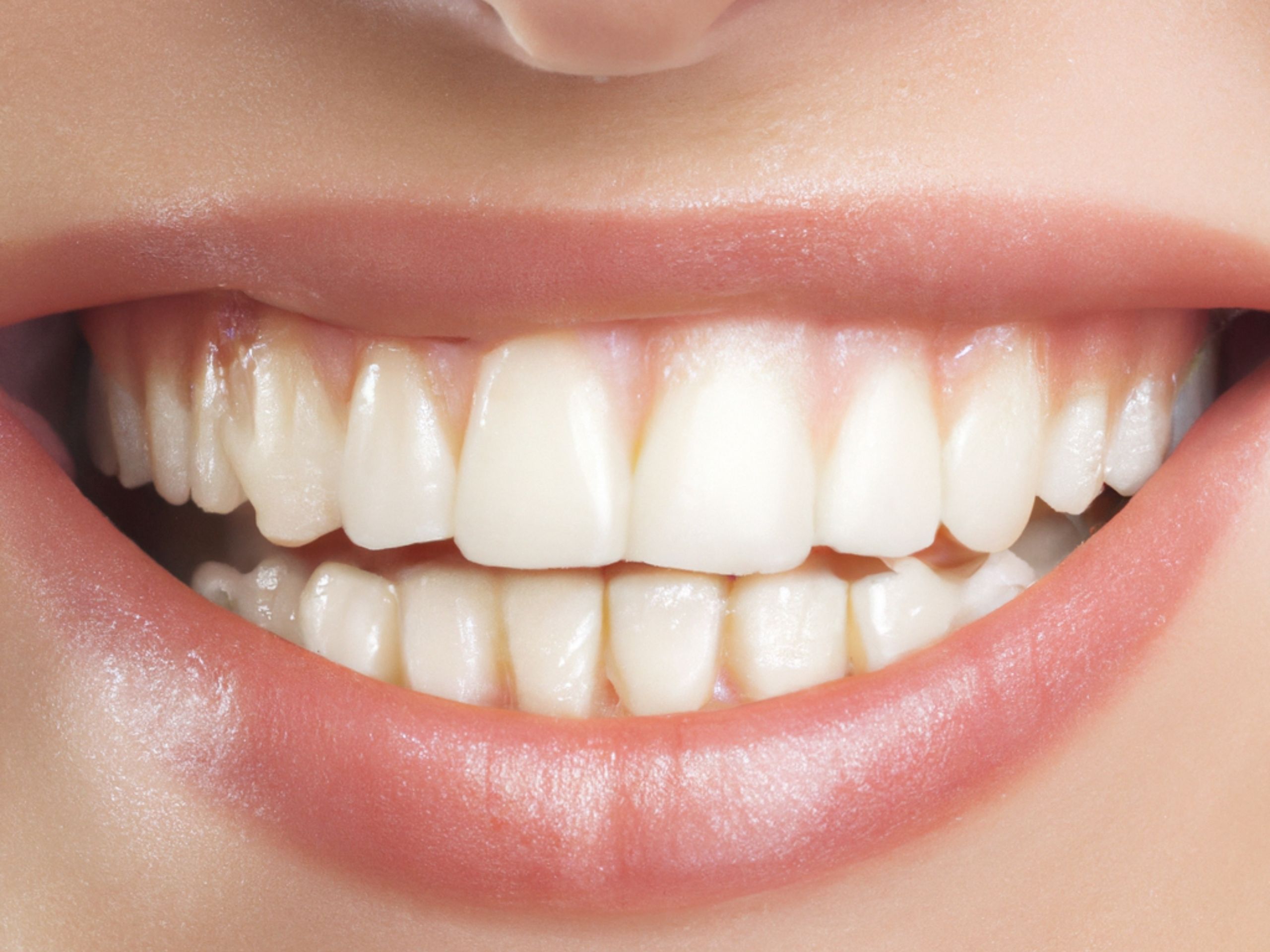 9. Look after your teeth and gums